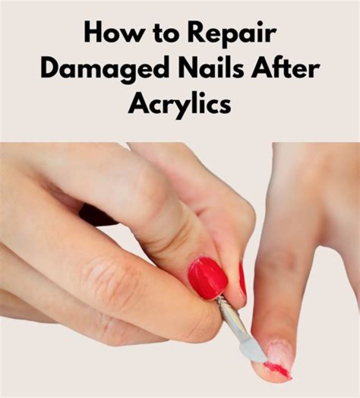 Acrylic nail damage - How To Discuss
