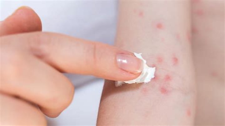 Allergic Reaction To Maybelline Bb Cream