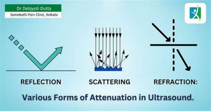 Attenuation - How To Discuss