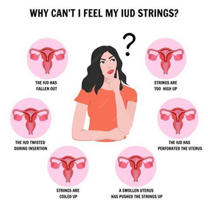 Can T Feel Iud Strings Anymore