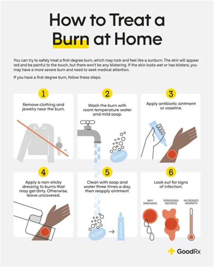 Carpet burn - How To Discuss