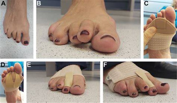 Devils Toe - How To Discuss