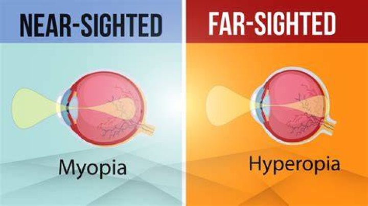 Difference Between Farsighted And Nearsighted