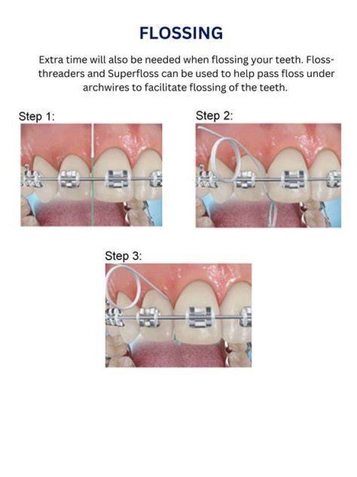 Does Wellcare Cover Braces - How To Discuss