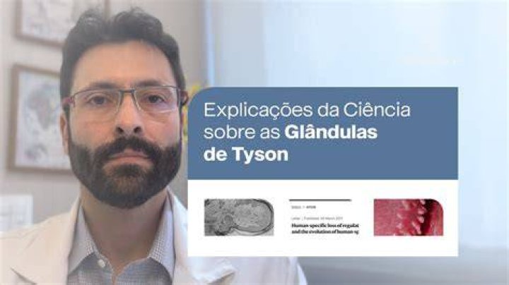 Glandulas De Tyson - How To Discuss