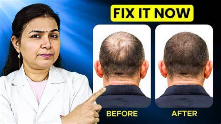 Hair thinning treatment female - How To Discuss