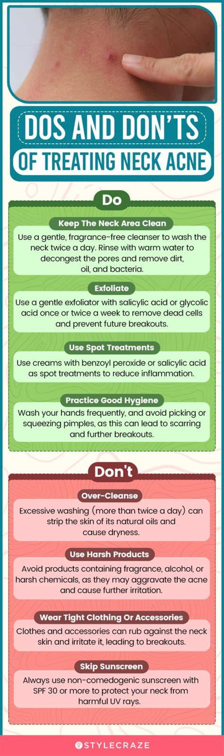 How to get rid of neck acne