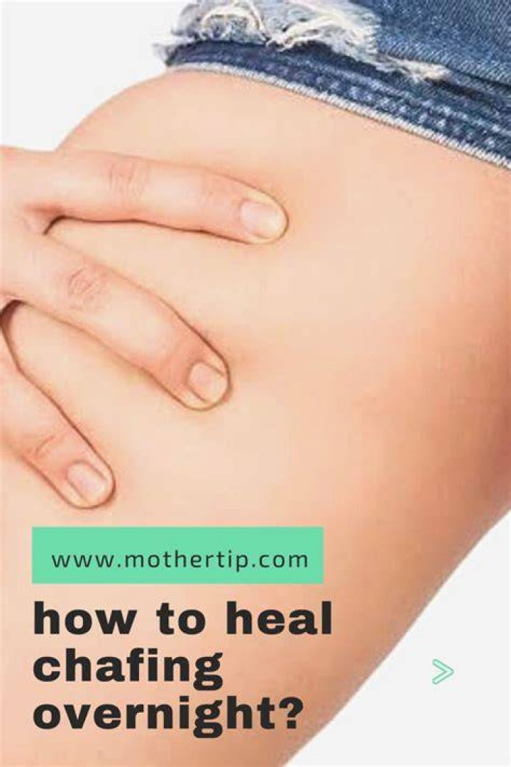 How To Heal Chafing Overnight
