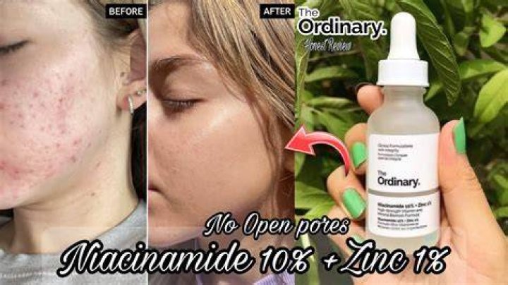 How to use the ordinary niacinamide