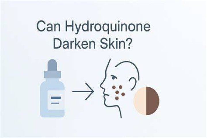 Is hydroquinone safe - How To Discuss