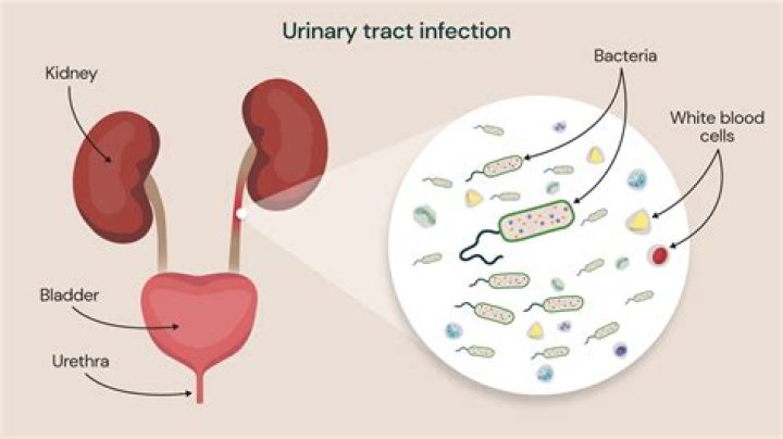 Is Uti Legit - How To Discuss