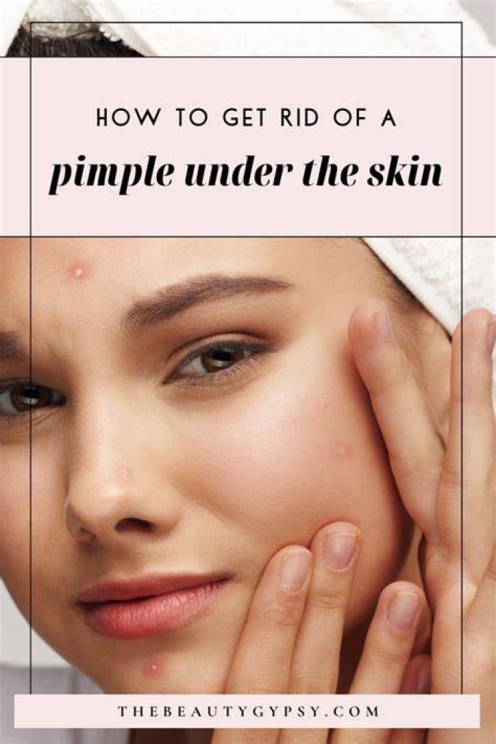 Painful pimple under skin - How To Discuss