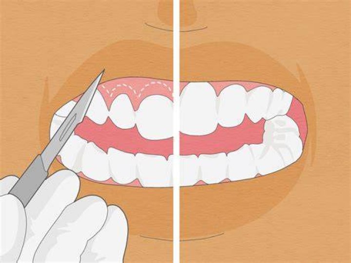 Push Teeth Back With Fingers
