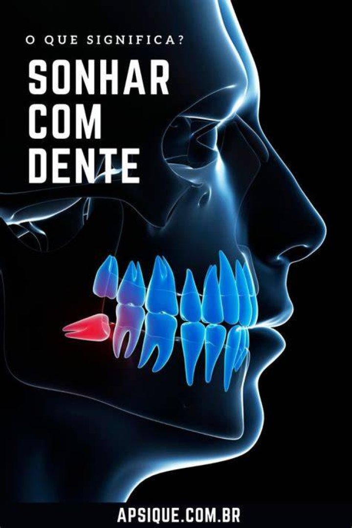 Sonhar Com Dente Branco - How To Discuss