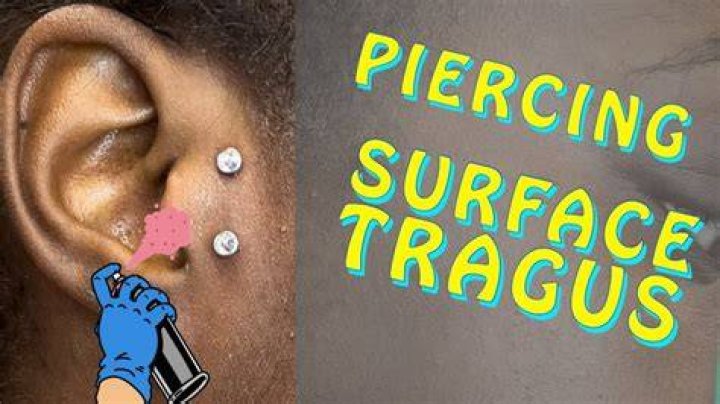 Surface Tragus Piercing - How To Discuss